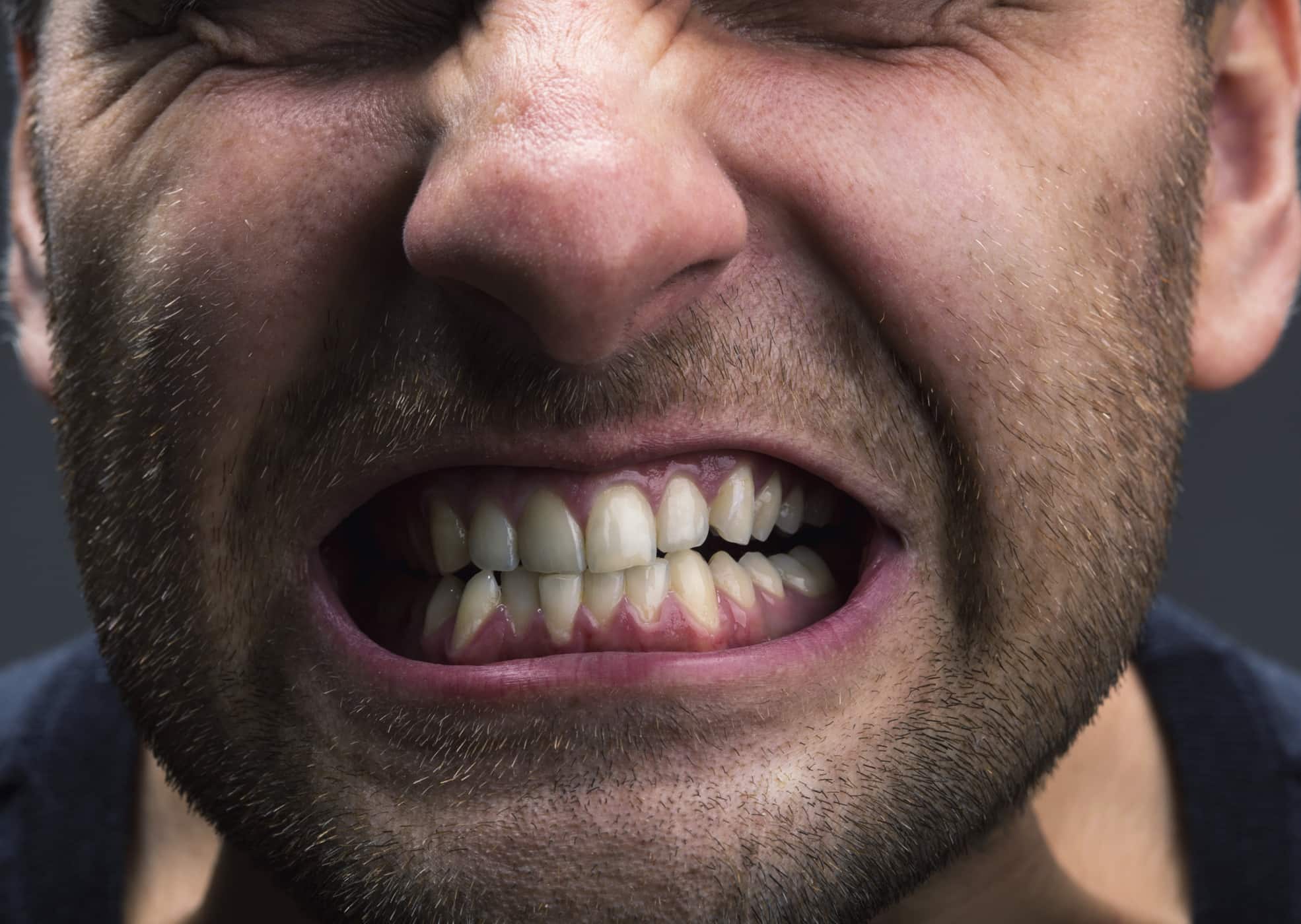 gangguan kesehatan mulut akibat stres - Masalah Gigi dan Mulut yang Mungkin Muncul Akibat Stres
